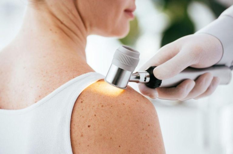 Dermatology